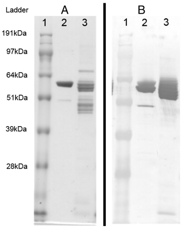 Development of a duplex Fluorescent Microsphere Immunoassay (FMIA) for the detection of antibody responses to influenza A and newcastle disease viruses - Image 2
