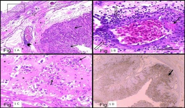 Clinical observations and pathology of the reproductive tract associated with natural infection of an avian influenza (AI) virus in an AI vaccinated layer flock - Image 1