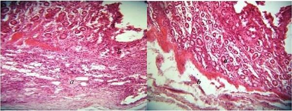 Histopathological changes in pigs infected with ileitis - Image 8