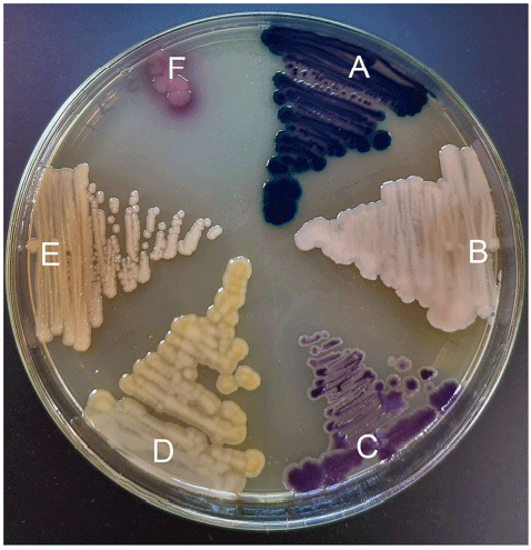 FIGURE 1 | Colistin-resistant organisms grown on CHROMagar COL-APSE agar for 48 h; (A) Aeromonas hydrophila isolate C17; (B) Alcaligenes faecalis isolate F12; (C) Hafnia paralvei isolate E14; (D) Myroides odoratus isolate B27; (E) Pseudochrobactrum spp. isolate F17; (F) E. coli ATCC 25922.