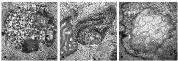 Porcine Circovirus Type 2 Morphogenesis in a Clone Derived from the L35 Lymphoblastoid Cell Line - Image 2