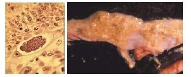 Coccidiosis in Poultry - Image 1