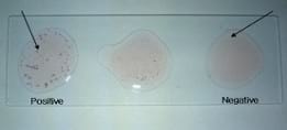 Development of Slide Micro-agglutination System for the Rapid Diagnosis of Salmonella Infection in the Chicken - Image 2