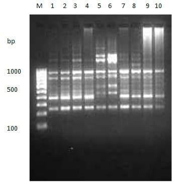 To evaluate genetic variation within and among the two different stocks of Catla catla in Orissa based on RAPD profiles - Image 9