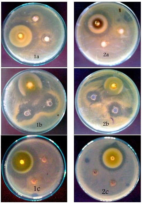 An In Vitro Study on the Effect of some Pre and Probiotics on some pathogenic Bacteria - Image 10