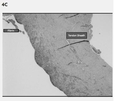 Mycoplasma hyosynoviae A Case Study: Quantitative assessment of incidence and severity across time alongside a diagnostic monitoring plan and intervention - Image 5