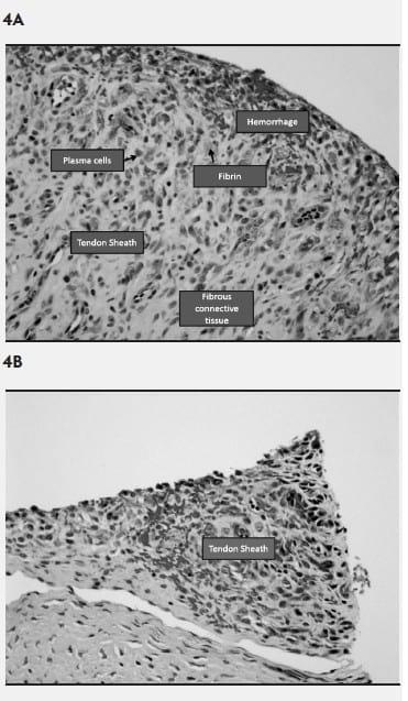 Mycoplasma hyosynoviae A Case Study: Quantitative assessment of incidence and severity across time alongside a diagnostic monitoring plan and intervention - Image 4