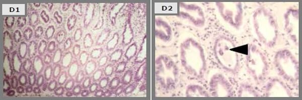 Probiotics reduce mortality and pathology in a standardised AHPND challenge model - Image 7