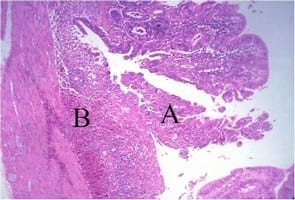 Impact of interaction between aflatoxicosis and cecal coccidiosis on broiler chickens - Image 10
