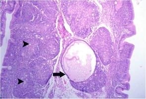Impact of interaction between aflatoxicosis and cecal coccidiosis on broiler chickens - Image 14