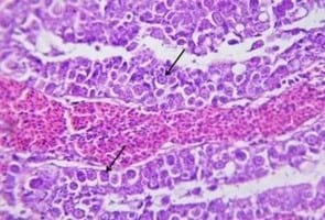 Clinical and laboratory studies on chicken Isolates of Clostridium Perfringens in El-Behera, Egypt - Image 12