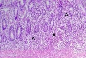 Clinical and laboratory studies on chicken Isolates of Clostridium Perfringens in El-Behera, Egypt - Image 14