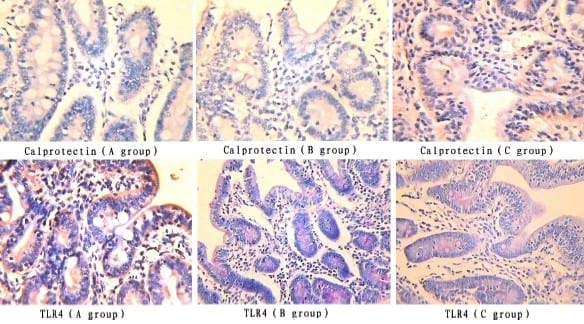 Effects of Chitosan on Intestinal Inflammation in Weaned Pigs Challenged by Enterotoxigenic Escherichia coli - Image 6