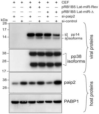 Poly(A) Binding Protein 1 Enhances Cap-Independent Translation Initiation of Neurovirulence Factor from Avian Herpesvirus - Image 7