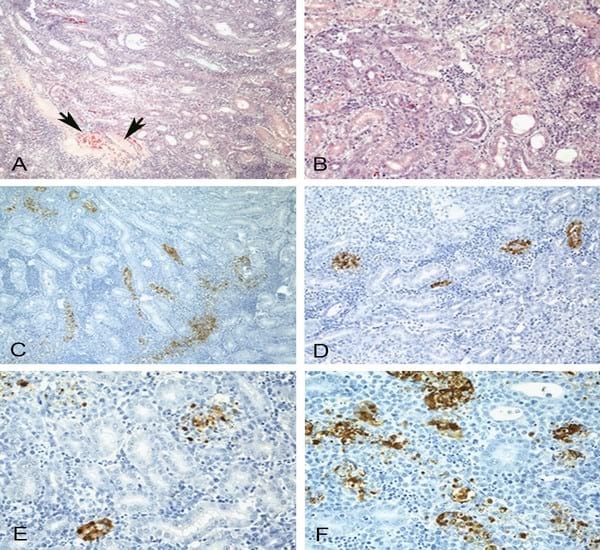 Impact of route of exposure and challenge dose on the pathogenesis of H7N9 low pathogenicity avian influenza virus in chickens - Image 10