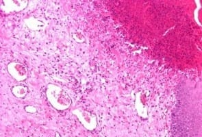 Study of animal welfare through analysis and comparison of the presence of foot pad dermatitis in broilers raised in controlled environments in Brazil and Spain - Image 6