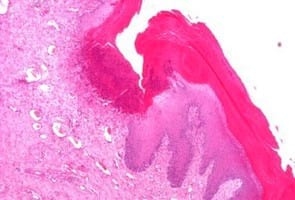 Study of animal welfare through analysis and comparison of the presence of foot pad dermatitis in broilers raised in controlled environments in Brazil and Spain - Image 5
