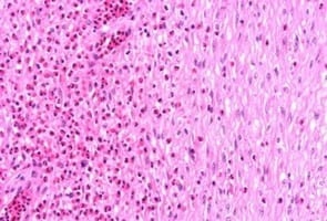 Study of animal welfare through analysis and comparison of the presence of foot pad dermatitis in broilers raised in controlled environments in Brazil and Spain - Image 9