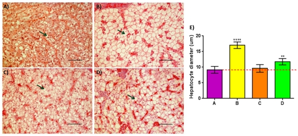Nutrigenomic and Nutritional Analyses Reveal the Effects of Pelleted Feeds on Asian Seabass (Lates calcarifer) - Image 10