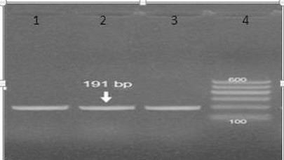 Mycoplasma Synoviae and other Associated Bacteria Causing Arthritis in Chicken - Image 11