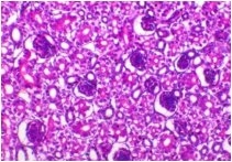 Incidence of Avian Nephritis and Infectious Bronchitis Viruses in Broilers in Egypt - Image 13