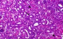 Incidence of Avian Nephritis and Infectious Bronchitis Viruses in Broilers in Egypt - Image 11