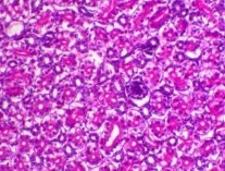 Incidence of Avian Nephritis and Infectious Bronchitis Viruses in Broilers in Egypt - Image 16
