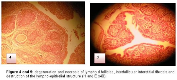 Diagnosis of chicken Gumboro disease by histopathological study of the bursa of Fabricius - Image 4
