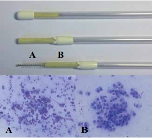 Postpartum uterine diseases in dairy cows: a review with emphasis on subclinical endometritis - Image 6