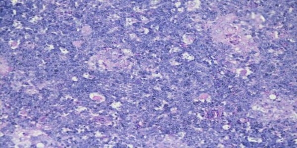 Role of histopathological examination in diagnosis of avian leucosis virus subtype J in broiler chicken in Egypt - Image 34