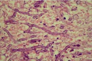 Case Report: Prevalence and significance of aspergellosis in commercial broiler chicken: Pathological study - Image 5