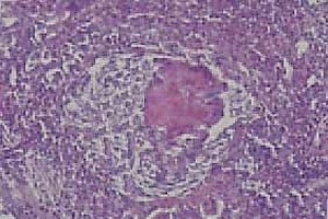 Case Report: Prevalence and significance of aspergellosis in commercial broiler chicken: Pathological study - Image 4