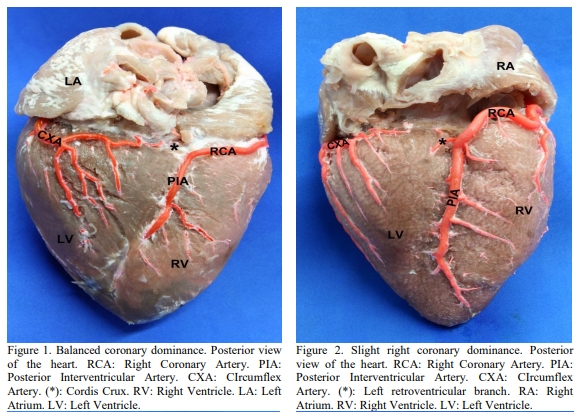 Evaluation of coronary dominance in pigs; a comparative study with findings in human hearts - Image 3