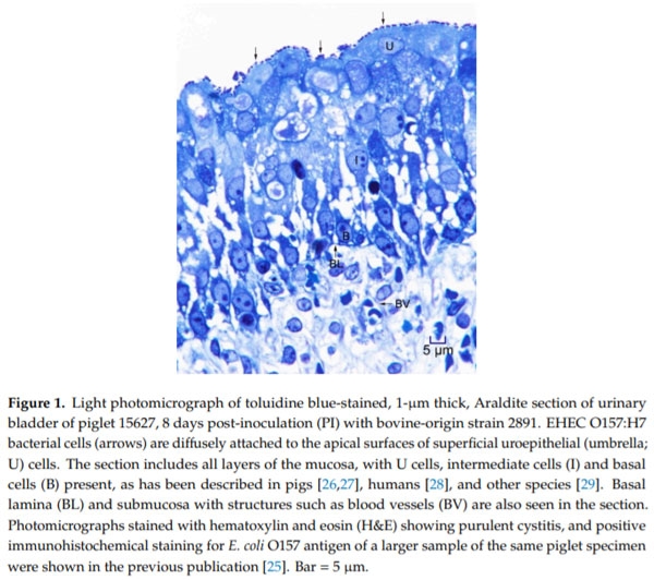 Intimate Attachment of Escherichia coli O157:H7 to Urinary Bladder Epithelium in the Gnotobiotic Piglet Model - Image 2
