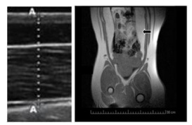 Metformin Alleviates Obesity and Systemic Oxidative Stress in Obese Young Swine - Image 4