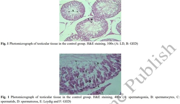 Evaluation of Sperm Parameters, Reproductive Hormones, Histological Criteria, and Testicular Spermatogenesis Using Turnip Leaf (Brassica Rapa) Hydroalcoholic Extract in Male Rats: An Experimental Study - Image 4
