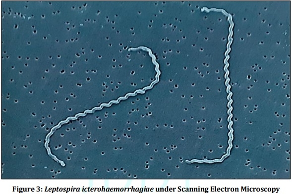 Vaccine Preperative Trial for Leptospirosis and their Pathological, Immunological Study by Serum Electrophoresis - Image 3