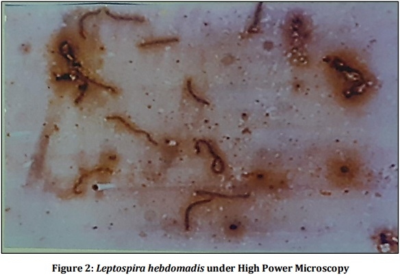 Vaccine Preperative Trial for Leptospirosis and their Pathological, Immunological Study by Serum Electrophoresis - Image 2