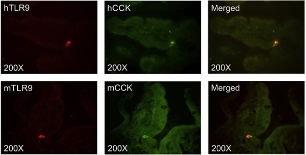 Toll-like receptor 9 expressed in proximal intestinal enteroendocrine cells detects bacteria resulting in secretion of cholecystokinin - Image 2