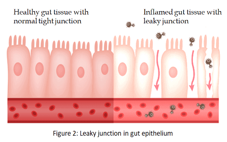 Major factors of Gut Health Issues
