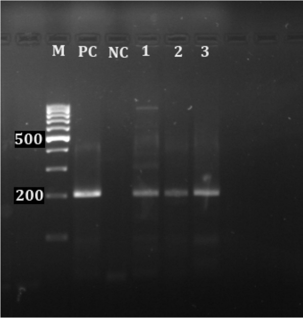Monitoring of aquatic birds and surveillance of avian influenza and Newcastle disease of waterfowls at the National Park of Urmia Lake - Image 17