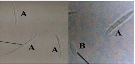 Identification and Production of Beauvericin by Fusarium subglutinansand F. sacchari from Sugarcane - Image 6