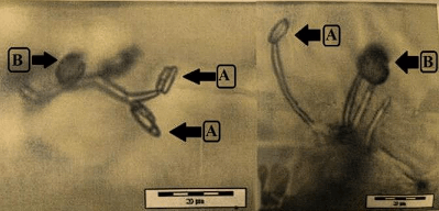 Identification and Production of Beauvericin by Fusarium subglutinansand F. sacchari from Sugarcane - Image 7