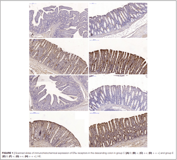 The Effect of 42-Day Exposure to a Low Deoxynivalenol Dose on the Immunohistochemical Expression of Intestinal ERs and the Activation of CYP1A1 and GSTP1 Genes in the Large Intestine of Pre-pubertal Gilts - Image 1