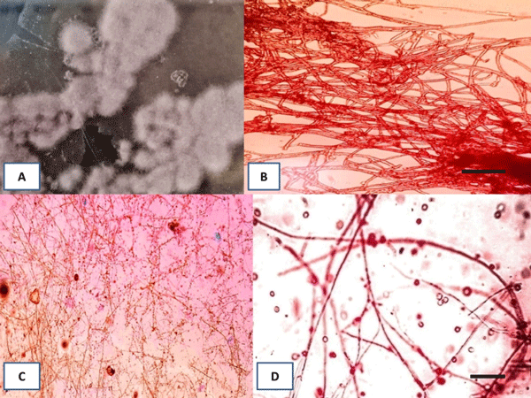 Fig 1. Representative pictures of P. lilacinum. (A) Fungus culture on PDA media. (B) Mycelium of fungi. Scale bar = 25 μm (C and D) Mycelium and conidia of fungi. Scale bars = 50 μm.