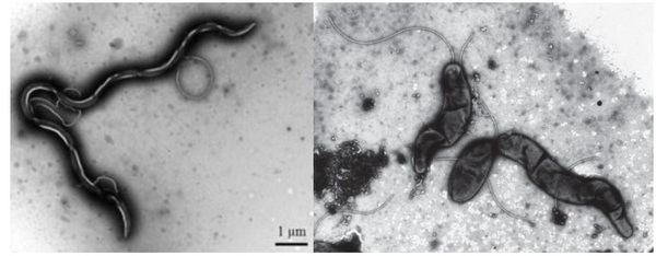 Brachyspira & Lawsonia: Similar Signs, Different Pathogens - Image 1
