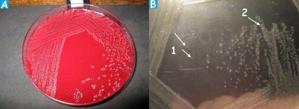 Fowl Cholera in poultry - Image 7