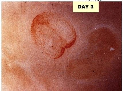 A Photographic Guide to Goose Embryo Development - Image 3