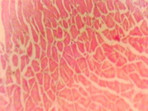 Effect of Source and Level of Dietary Water Hyacinth on Nile Tilapia Oreochromis Niloticus- Histopathology - Image 34