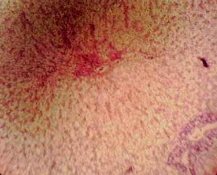Effect of Source and Level of Dietary Water Hyacinth on Nile Tilapia Oreochromis Niloticus- Histopathology - Image 3
